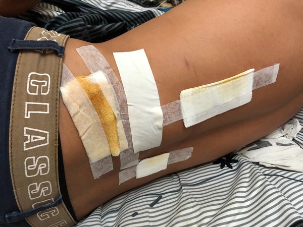 ▲蕭姓男子因工作摔落受傷,引起勞資糾紛。(圖/記者林悅翻攝,下同)