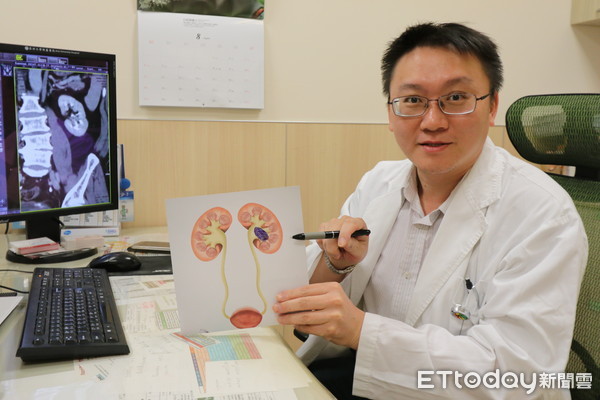 ▲▼圖片5113:亞大醫院震波碎石室主任石欣衛指出病灶位置。。(圖/亞大醫院提供)