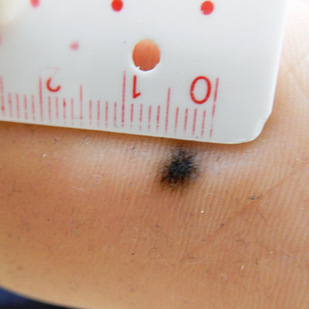 ▲▼痣。(圖/凱特文化提供)