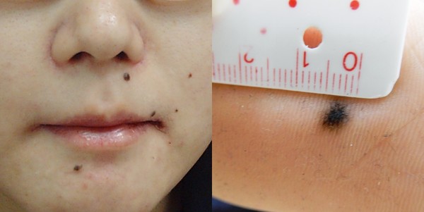 ▲▼痣。(圖/凱特文化提供)