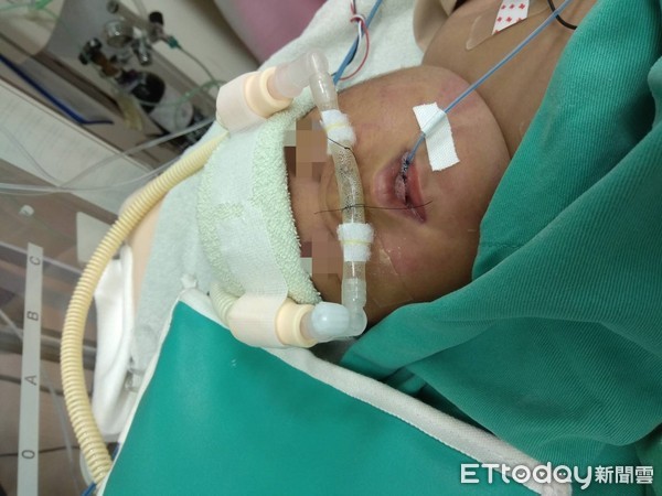 ▲▼女嬰插管喝奶。(圖/門諾醫院提供)