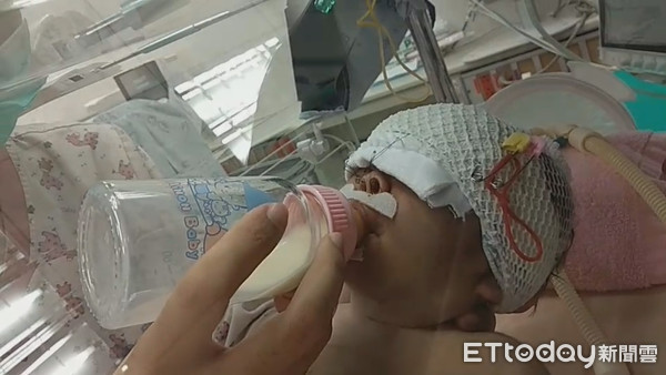 ▲▼女嬰插管喝奶。(圖/門諾醫院提供)