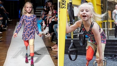 「不能忘記微笑！」無腿女孩戴義肢自信走秀　連紐約時裝周都邀她參加