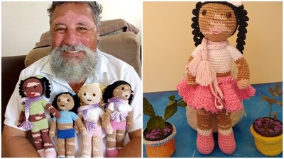 娃娃臉上白一塊！巴西老爹手織「白癜風娃娃」　鼓勵病童接受自己