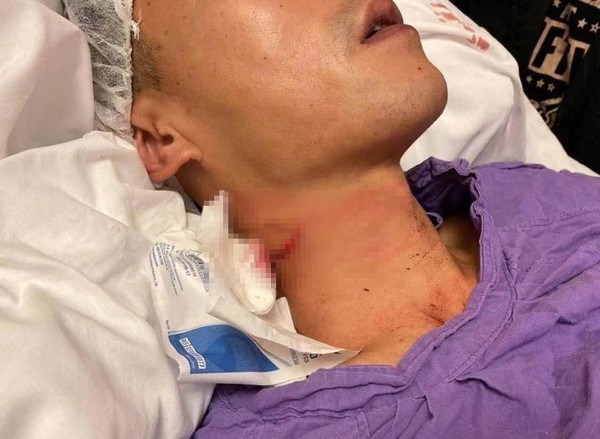 ▲▼港警的頸部遭到示威者割傷。（圖／翻攝自香港電台視像新聞）