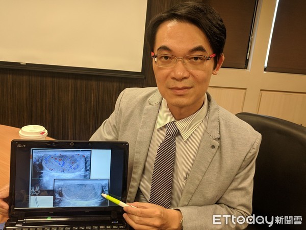 ▲蛋蛋變硬,竟是睪丸癌。書田診所泌尿科主任醫師洪峻澤。(圖/書田診所提供) ▲蛋蛋變硬,竟是睪丸癌。書田診所泌尿科主任醫師洪峻澤。(圖/書田診所提供)