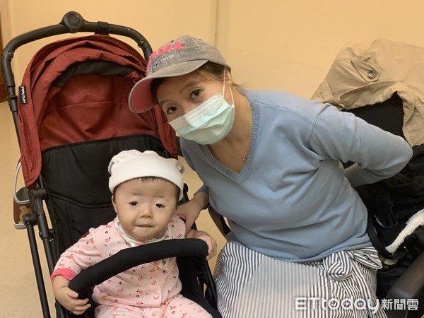 ▲顱縫早閉 。(圖/記者嚴云岑攝) ▲顱縫早閉 。(圖/記者嚴云岑攝)