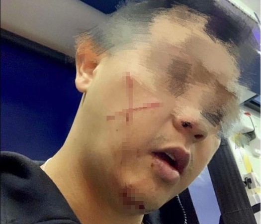 ▲▼港警值勤途中遭到陌生男子割傷臉部。（圖／翻攝自香港立法會議員葛珮帆臉書）