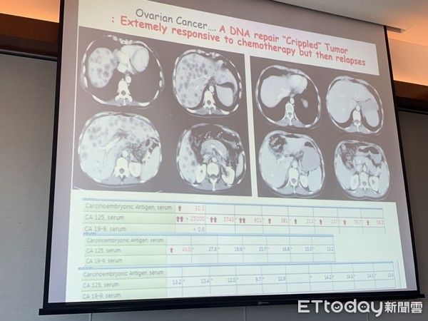 ▲ESMO Asia卵巢癌。(圖/記者嚴云岑攝) ▲ESMO Asia卵巢癌。(圖/記者嚴云岑攝)