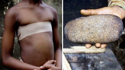 「不把乳房燙平，男人會侵犯你」西非10歲女童單純問：我做錯什麼了