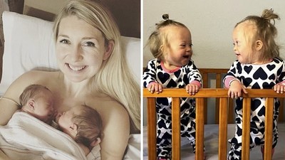 六位醫生勸她別生！39歲女懷上「唐氏症雙胞胎」堅持生下不在乎一生負擔