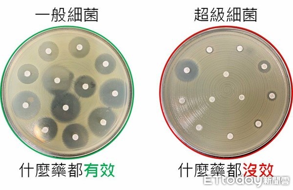 ▲林口長庚超級細菌預測模型。(圖/記者嚴云岑攝) ▲林口長庚超級細菌預測模型。(圖/記者嚴云岑攝)