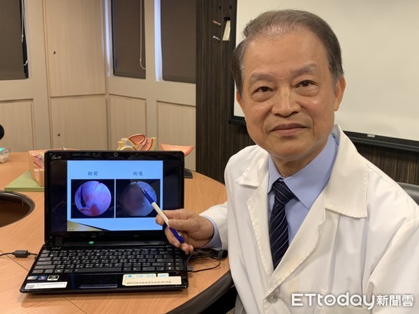 ▲4年前切過攝護腺!翁「尿出鮮血」慌就醫 竟是切掉組織長回來。(圖/記者嚴云岑攝) ▲4年前切過攝護腺!翁「尿出鮮血」慌就醫 竟是切掉組織長回來。(圖/記者嚴云岑攝)