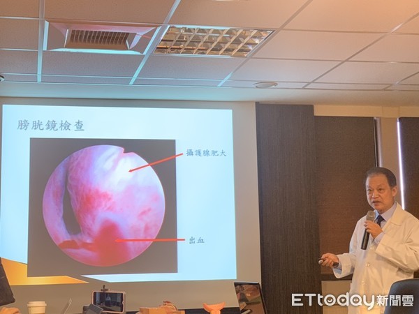 ▲4年前切過攝護腺!翁「尿出鮮血」慌就醫 竟是切掉組織長回來。(圖/記者嚴云岑攝) ▲4年前切過攝護腺!翁「尿出鮮血」慌就醫 竟是切掉組織長回來。(圖/記者嚴云岑攝)