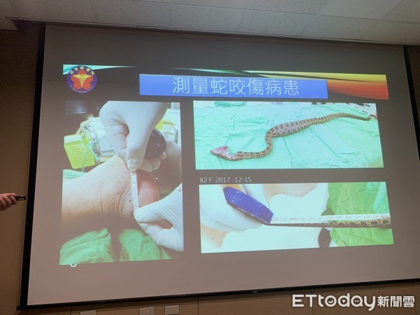 ▲超音波介入優化蛇咬傷病人治療情形。(圖/記者嚴云岑攝) ▲超音波介入優化蛇咬傷病人治療情形。(圖/記者嚴云岑攝)