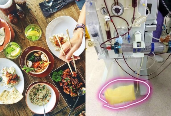 ▲每天吃外賣!28歲女突「呼吸困難+雙腳無力」...送醫抽出「黄色血液」嚇壞。(圖/翻攝微博、Pixabay) ▲每天吃外賣!28歲女突「呼吸困難+雙腳無力」...送醫抽出「黄色血液」嚇壞。(圖/翻攝微博、Pixabay)