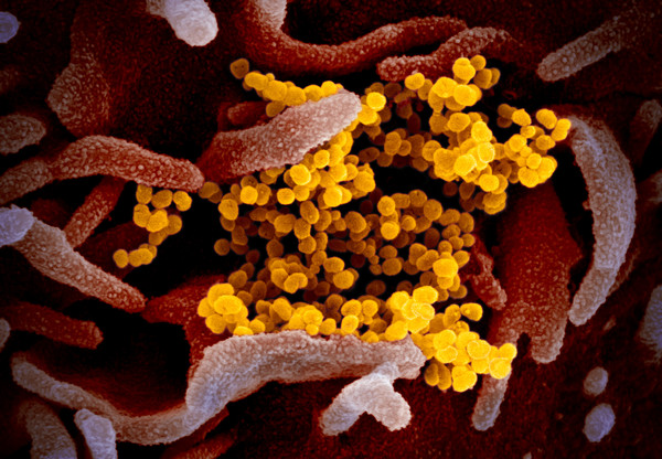 ▲▼新冠病毒顯微鏡彩照首度公佈。（圖／NIAID Flickr）