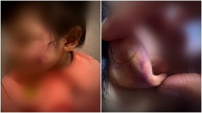 韓防疫「招生不足」受害者竟是3歲女童　幼兒園長虐打她1.5hr洩恨