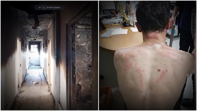 全南韓幫求情！　非法移工「捨命救人」遭烈火焚身　政府破例不遣返幫他治傷