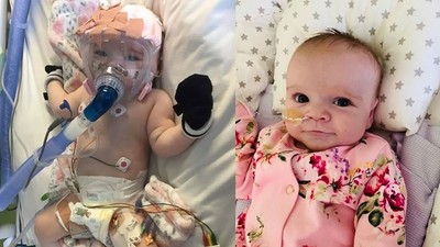 6個月女嬰擊退新冠病毒！心臟病也沒打倒她　醫生讚：勇敢的小戰士