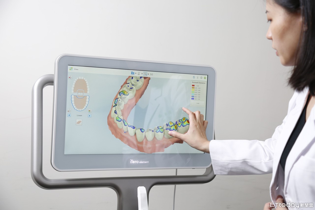 ▲iTero數位口腔掃描儀進駐數位美容牙科教學現場，創亞太先例。（圖／愛齊科技提供）