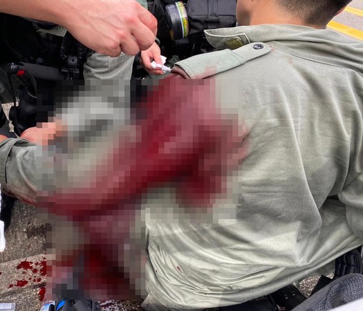 ▲香港警察被示威者攻擊，左肩受傷流血。（圖／香港警察臉書）