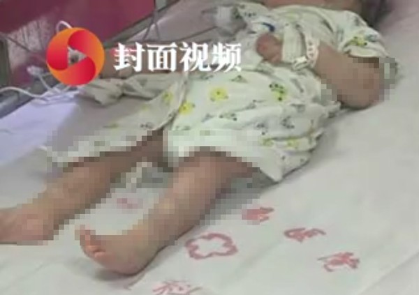 ▲成都一名1歲男童被媽媽打傷住院。（圖／翻攝自封面新聞）