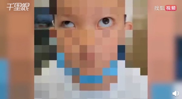 6歲男童模仿App特效「徒手挖眼球」　左眼向外凸出差點失明！（圖／翻攝自搜狐視頻）