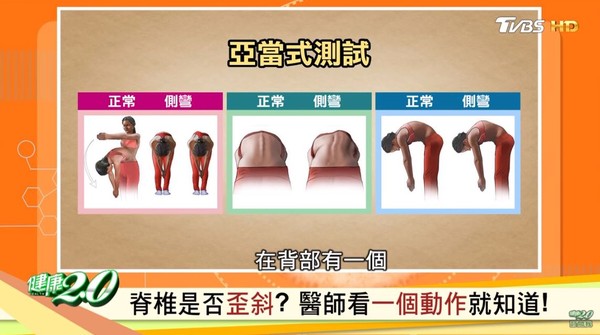 ▲▼亞當式測試。(圖/截自節目健康2.0) ▲▼亞當式測試。(圖/截自節目健康2.0)