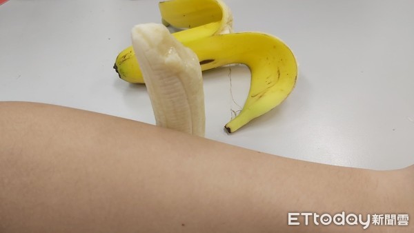 ▲▼英國男子6年前敗血症陰莖脫落，醫生決定在手上「種香蕉」。（示意圖／記者羅翊宬攝）