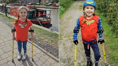 6歲罕病女「走300km募款」　拄拐杖不畏病痛：想幫助跟我一樣的人