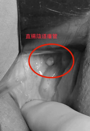 李偉浩在粉專分享收治個案。（圖／翻攝自Dr. 李偉浩 婦女健康諮詢網臉書，下同）