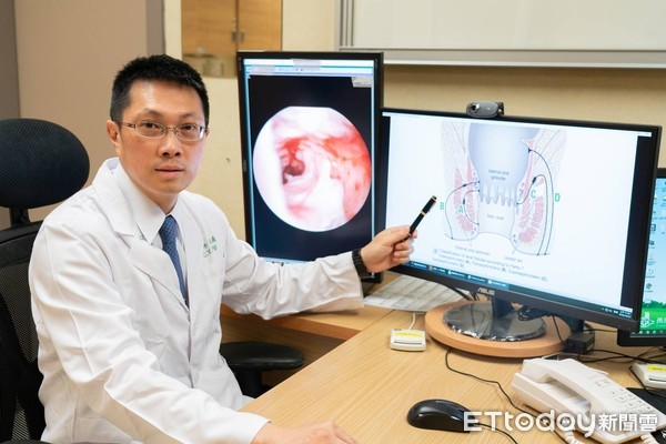 ▲▼ 說不出口的屁屁痛—肛門廔管鏡解決「複雜性肛門廔管」 。(圖/記者翁伊森翻攝) ▲▼ 說不出口的屁屁痛—肛門廔管鏡解決「複雜性肛門廔管」 。(圖/記者翁伊森翻攝)
