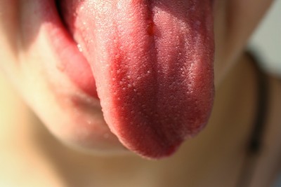 美國媽舌頭罹癌切除左半邊！　醫生拿大腿皮膚補「竟長出腿毛」