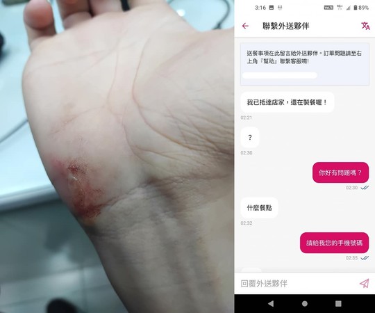 ▲外送員遭客人咬傷,客人也發文。(圖/翻攝自爆料公社二社,下同) ▲外送員遭客人咬傷,客人也發文。(圖/翻攝自爆料公社二社,下同)