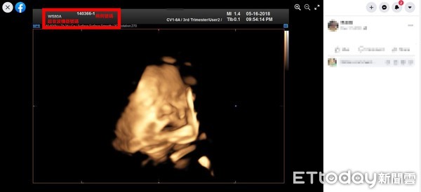 ▲罔腰貼出的懷孕超音波照片，跟表妹的超音波照片對照           。（圖／翻攝當事人臉書）
