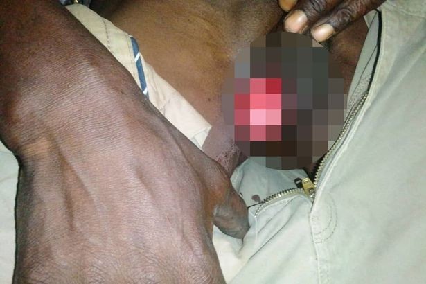 ▲▼元配怒啃下體「報復性結紮」! 9寶爸陪睡二奶下場慘:性生活歸零。(圖/翻攝自「拉丁時報」) ▲▼元配怒啃下體「報復性結紮」! 9寶爸陪睡二奶下場慘:性生活歸零。(圖/翻攝自「拉丁時報」)