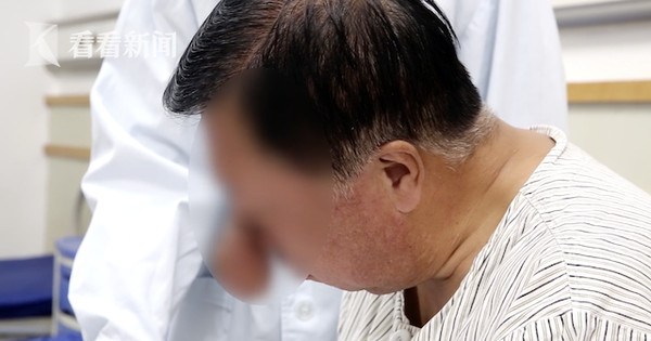 ▲大陸遼寧一名李姓男子因長年喝酒使鼻子長出增生物,形狀如同象鼻。(圖/翻攝看看新聞) ▲大陸遼寧一名李姓男子因長年喝酒使鼻子長出增生物,形狀如同象鼻。(圖/翻攝看看新聞)