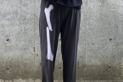 我就骨折！日本妹印製「X光透視風褲」　樂觀展現自信：受傷但我一樣潮