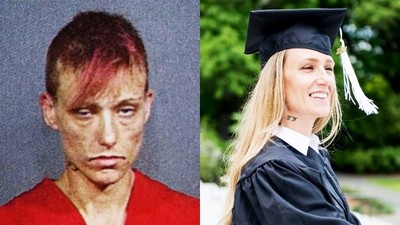 這是同一人！毒癮女po「戒毒驚人對比」6歲開始吃毒、如今戴上名校畢業帽