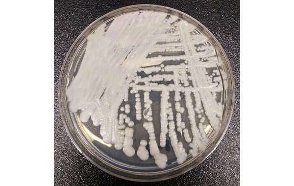 ▲▼ 美國CDC於2016年提供實驗室培養皿中的念珠菌照片。（圖／達志影像／美聯社）