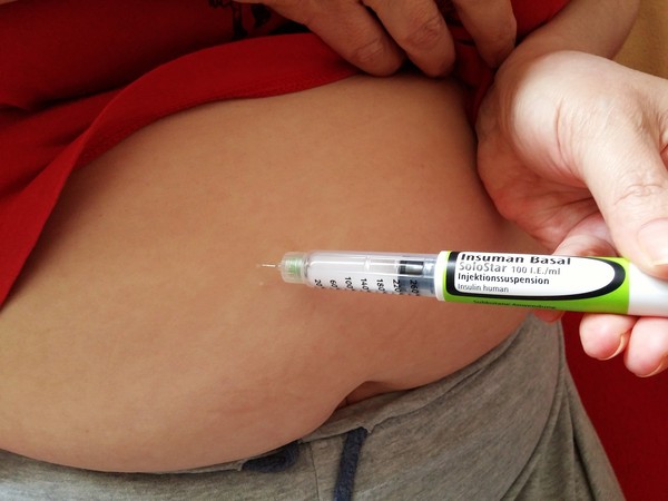 ▲▼糖尿病患者注射胰島素的針頭屬拋棄式，應用完即丟。（圖／取自免費圖庫pixabay）