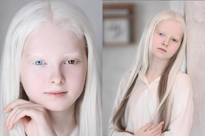 購物遇見「絕美精靈少女」！12歲白化女孩逛街被攝影師發掘　變身精靈系模特