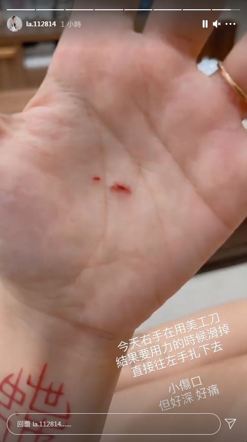 ▲蕾菈用美工刀受傷。（圖／翻攝自Instagram／la.112814）