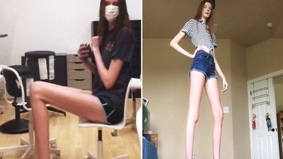 沒P圖！17歲少女「腿長1米35公分」佔全身60％　好怕交不到男友