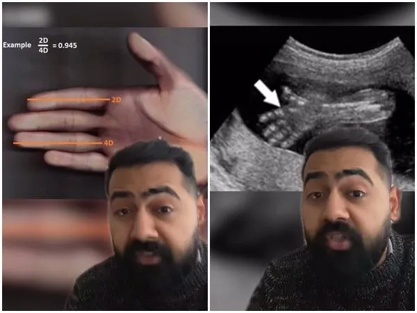 ▲▼英國醫師表示,手指長短可以判斷男性陰莖尺寸。(圖/翻攝TikTok@dr.karanr)