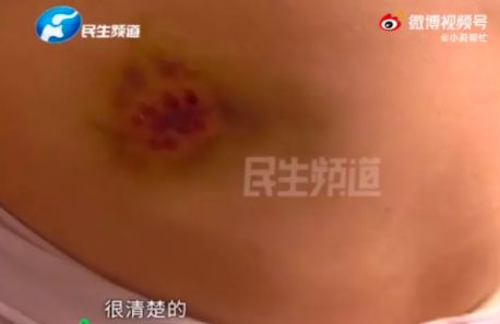 ▲▼ 安陽狗咬人。(圖/翻攝自微博)