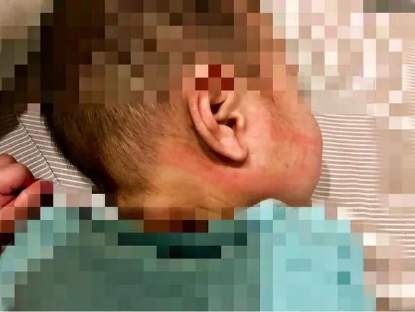 ▲▼板橋1歲男童疑遭虐 。(圖/當事人提供)