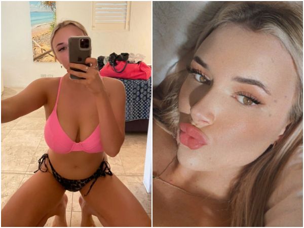 ▲▼澳洲21歲巨乳正妹巴妮特(Annie Barnett)腦中長了5顆動脈瘤,醫師削去她的部分顱骨,才救回她一命。(圖/翻攝自IG/annie.barnett)