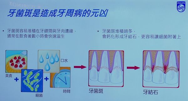 ▲牙周病發生主要原因在於口腔清潔不當。（圖／記者姜國輝翻攝）